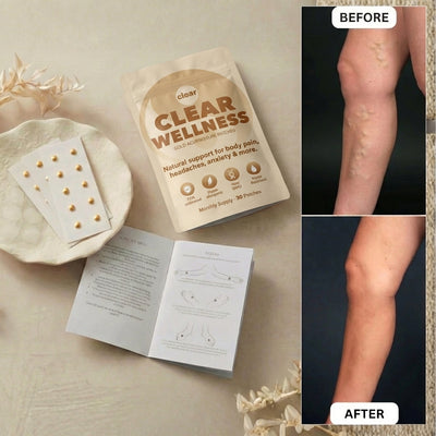 Magnetic Acupressure Patches.