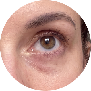 Apply under your eyes
