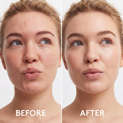 All tone Foundation