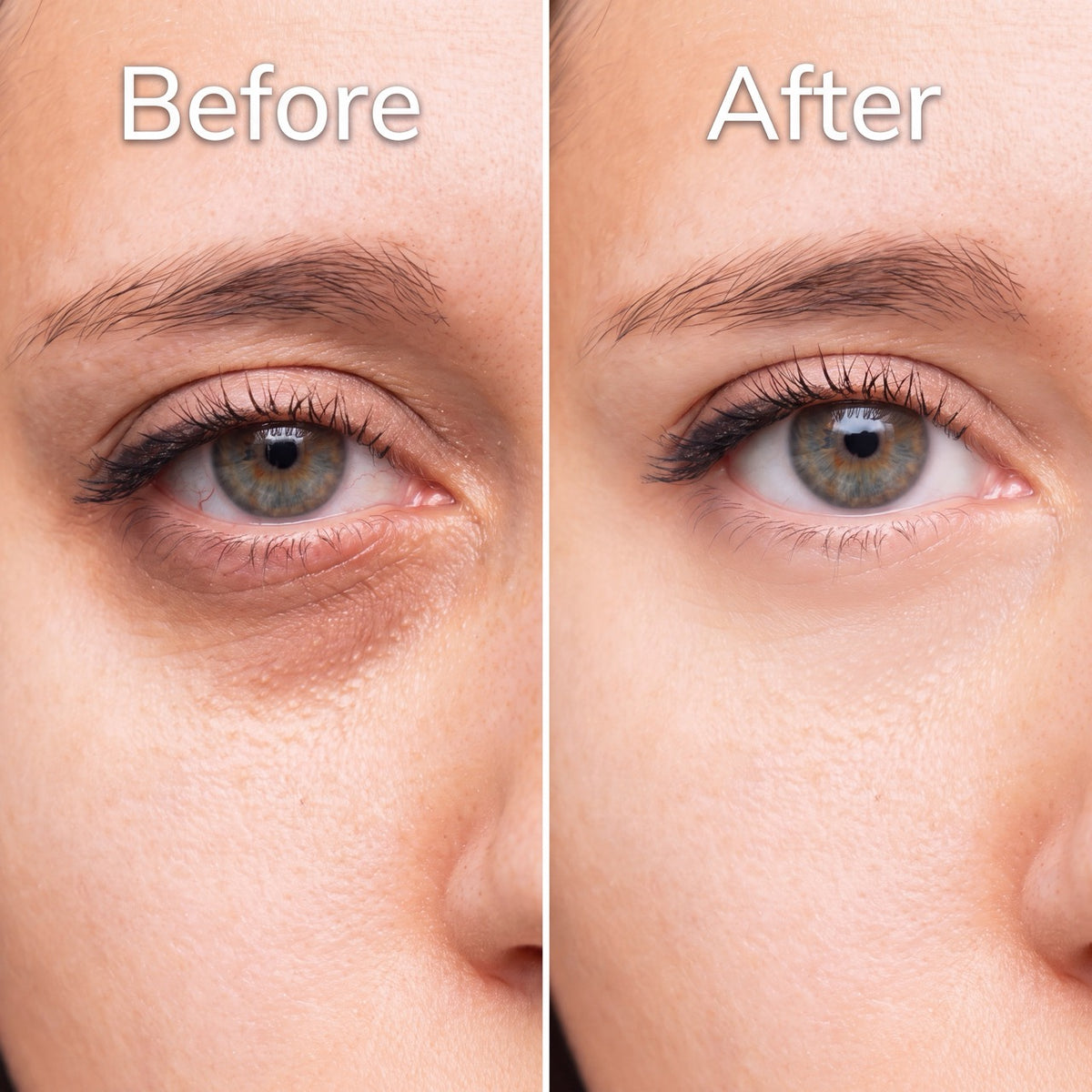 Anti Dark-Spot Under-Eye Cream