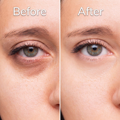Anti Dark-Spot Under-Eye Cream