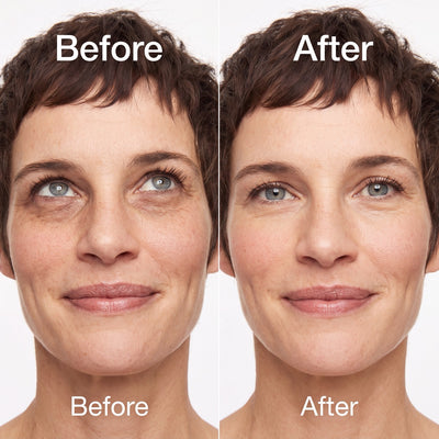 Anti Dark-Spot Under-Eye Cream